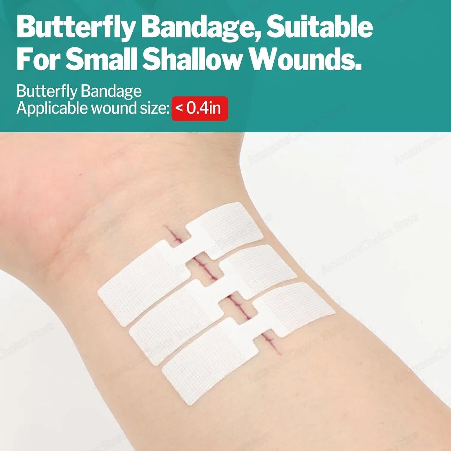 Bandes pour Fermeture de Plaies, Kit d'Urgence